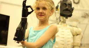 Nominet Trust child with bionic arm